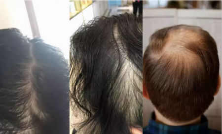 唯拾壹跨境美妝|我缺的不是卷發棒！不是錢！是頭發啊