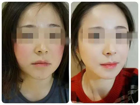 拒絕春季過(guò)敏、紅腫、發(fā)癢！敏感肌的救星來(lái)啦~