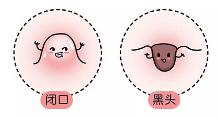 “閉口”這個磨人的小妖精又出來作妖啦！