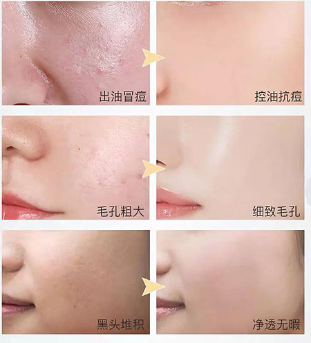 韓詩緹教你正確洗臉，現在！立刻！馬上！改善皮膚問題