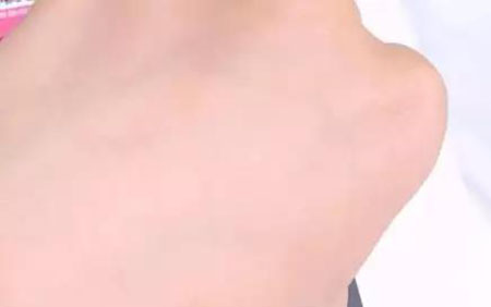 敏感肌不能化妝？良心推薦這款修復遮瑕霜！