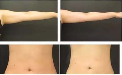 操作30分鐘，腰圍減少3-6公分”這種健康美容瘦身的方法你知道嗎